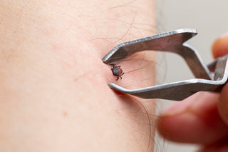 Tick Removal Service