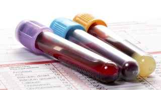Phlebotomy Service