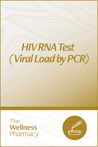 HIV RNA Test (viral load by PCR)