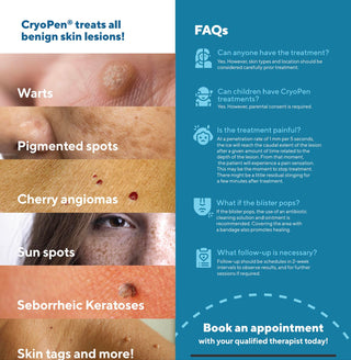 Cryotherapy Treatment (Warts & Skin Tag Removal)